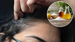 白髪を改善するために酢と重曹を使うメリットは何ですか？また、正しい使い方はどのようなものでしょうか？